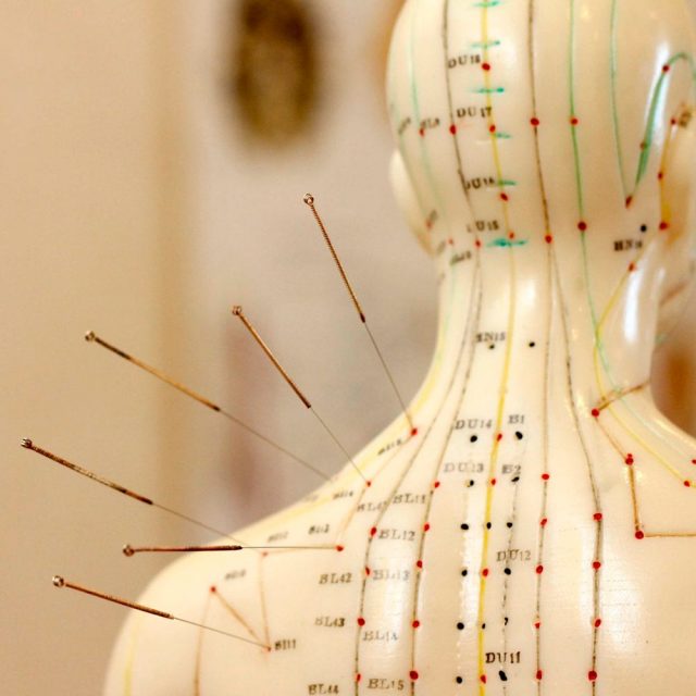 Acupuntura y Agujas.